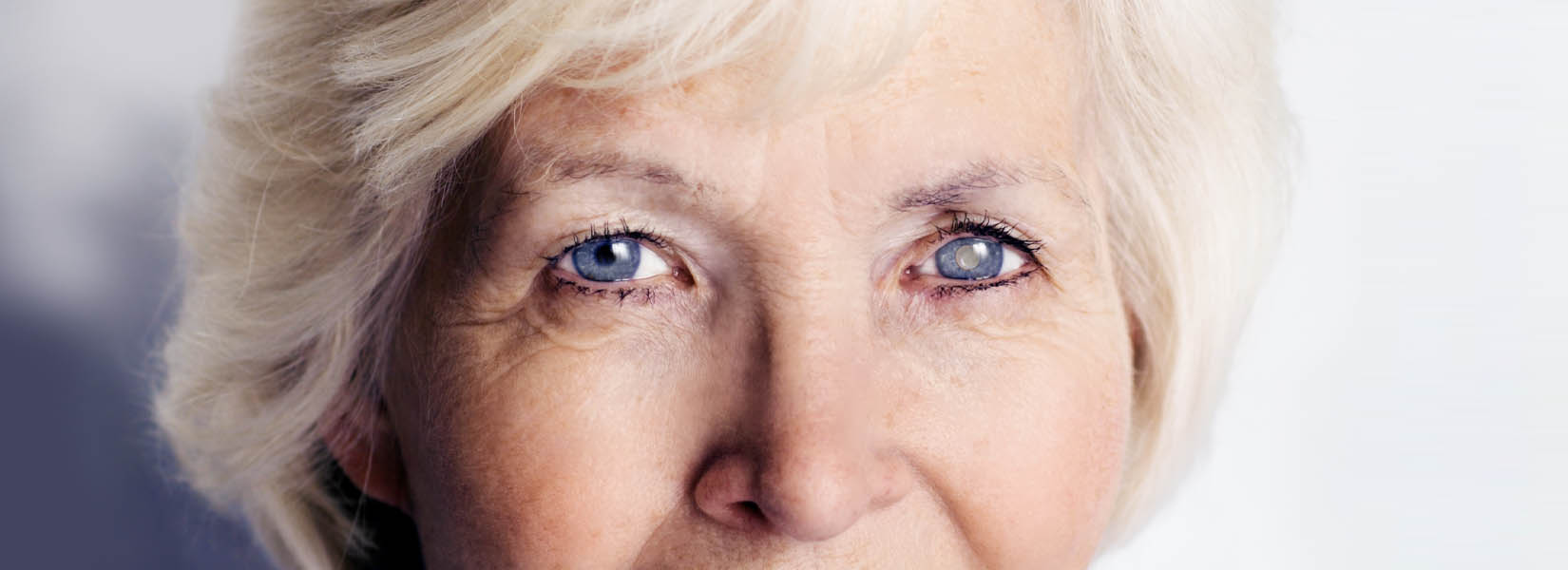 Cataract Surgery in White Bear Lake